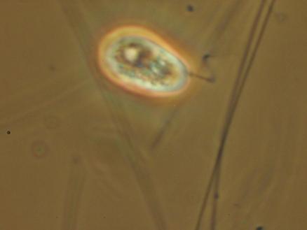 Figur 1 Bilder tagna under mikroskopstudier. Filamentösa bakterier (övre höger) samt en protozo (övre vänster) i L2A den 11e april. En högre ordningens organism i L2E den 25e april (nedre höger). 2.3.