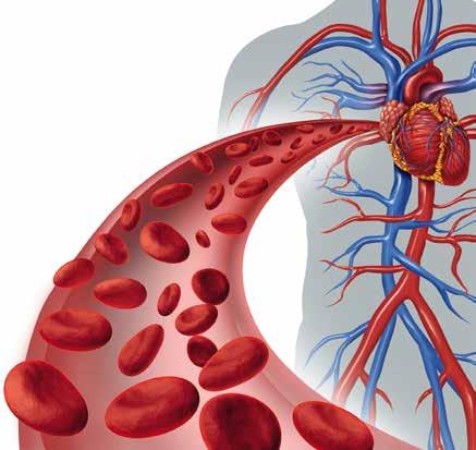 FAKTA PERSONER MED DIABETES RISKERAR ATT FÅ STROKE Personer med typ 2-diabetes har 30 procent högre risk att få hjärtinfarkt, fyra till fem gånger högre risk att drabbas av hjärtsvikt och dubbelt så