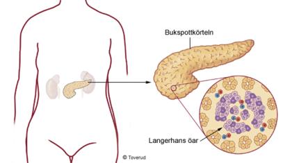 Annat medicinskt ändamål Avser medicinska forskningsprojekt som syftar till att ta fram bättre behandlingsmetoder för olika sjukdomar, t.ex. diabetes.