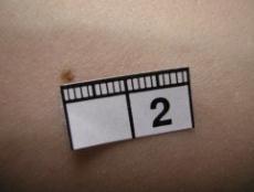 1 Handhavande Använd ofärgad ultraljudsgel. Lägg en stor klick på dermatoskophuvudet (bild 6).