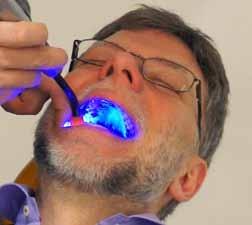 Offentlig upphandling Offentlig upphandling riskerar patienthälsan De upphandlingsregler som finns idag ställer till en del problem för den offentliga tandvården, särskilt när det gäller tandtekniska