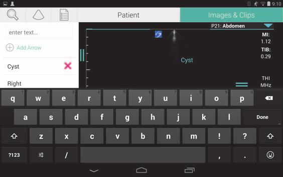 Skriva in text Vid ifyllning av formulär i SonoSite iviz, som vid uppdatering av patientposter eller konfigurering av inställningar, kan du skriva in text genom att peka på det textfält som du vill