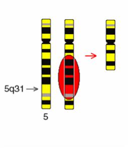 Immunmodulerande behandling Lenalidomid (thalidomid-analog) àmycket potent vid lågrisk MDS med del(5q) 2 av 3 blir transfusionsfria Nästan 50% uppnår komplett cytogenetisk remission