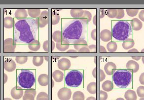 färgskala presenterad i tabell 3 och figur 1 visades en genomsnittlig överfärgning i de flesta celltyper och deras strukturer.