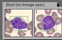 Granula hos neutrofila skilde sig däremot från denna iakttagelse, eftersom dess genomsnittliga färgskala hamnade runt -1 som