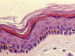 Strålkänslighet hud Hud-histologi EPIDERMIS DERMIS Basala stratum