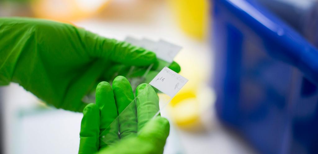 42 Cancerfondsrapporten 2018 Livmoderhalscancer Kapitelnamn 43 Rehabiliteringsbehovet är stort I många landsting fungerar inte systemet med självprovtagning för kvinnor som av olika skäl inte kommer