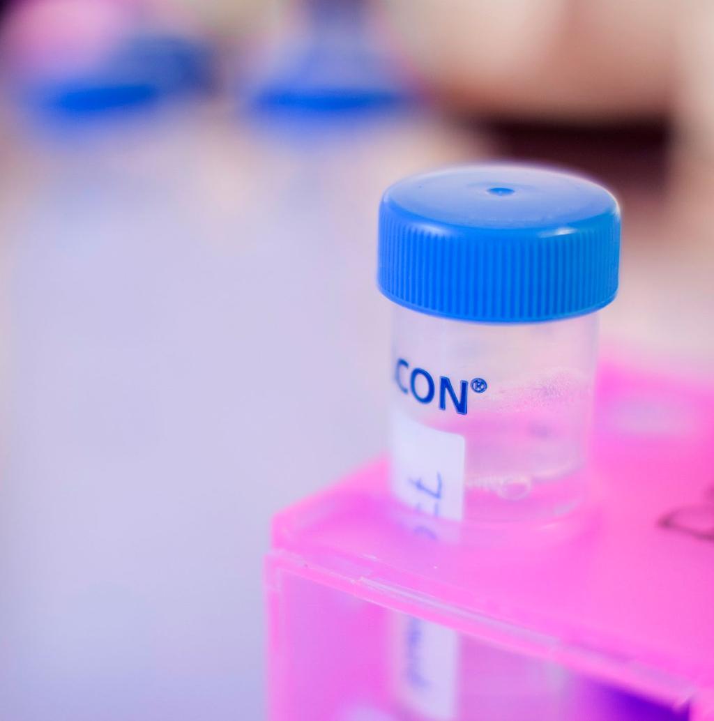 10 Cancerfondsrapporten 2018 Kapitelnamn Statistik 11 Visste du att... den cancersjukdom som ökar mest är hudcancer.