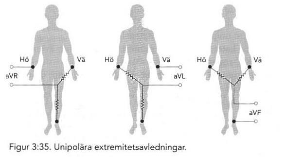 Unipolära extremitetsavledningar, avr, avl, avf För att underlätta analysen av EKG-kurvan vill man mäta potentialskillnaden mellan en mätpunkt som inte varierar under hjärtcykeln, referenspunkt, och