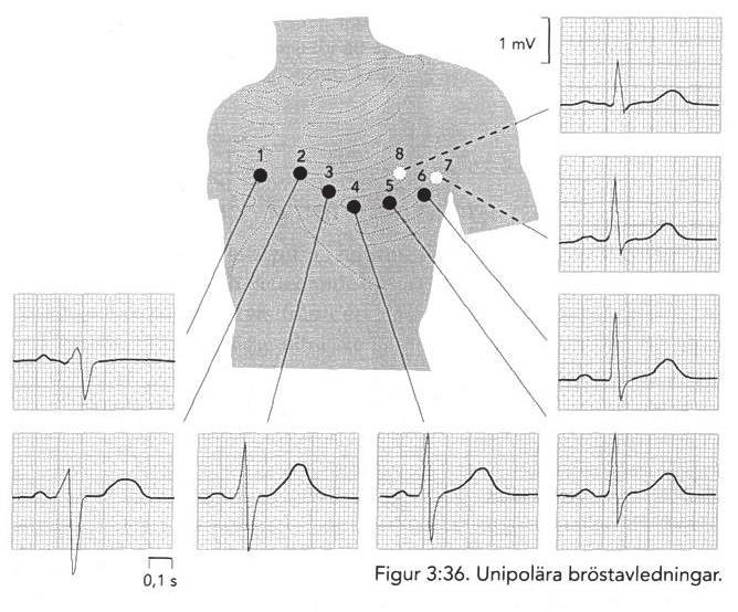 Inom klinisk fysiologi brukar man använda ett standardsystem med 12 avledningar.