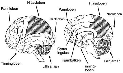 Genetik vid AD/HD Ovanliga kromosomförändringar kan vara associerade med AD/HD-symtom Ospecifik genetiskt betingad sårbarhet (känslighet) för psykosocial belastning finns Personlighetsdrag kan vara