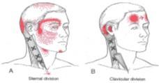 Travell & Simons MyofascialPain and Dysfunction: TheTrigger Point Manual Nacken och yrsel Devaraja K. Approach to cervicogenic dizziness: a comprehensive review of its aetiopathology and management.
