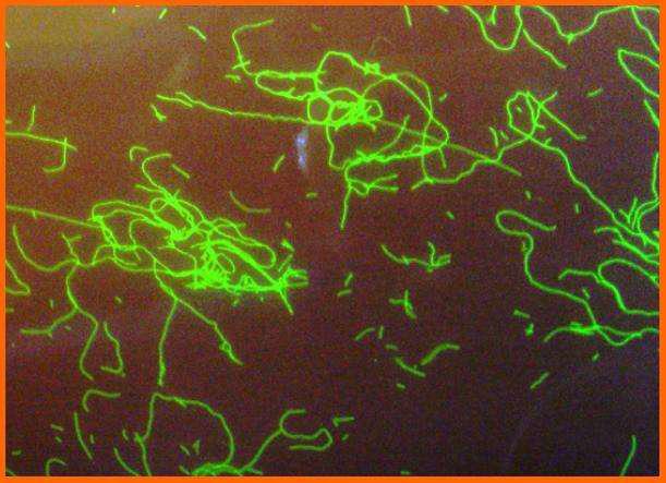 Tandläkare död i Legionella-infektion.