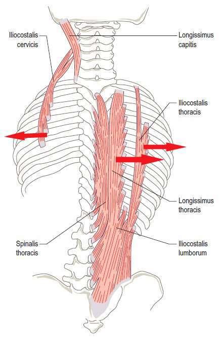 2.Ryggmuskler som klämmer på intercostal nerven De djupa ryggmusklerna (posurala) blir förkortade vid överansträngning p.g.r. dålig hållning och klämmer då ihop revbenen och interkostal nerven, vilket orsakar smärta.