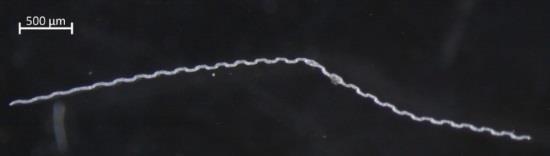 Mikroplast