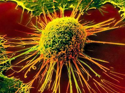 Afrikanskt Svinpest Förorsakare Asfivirus Bekämpas officielt: TOP 1