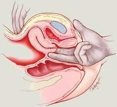 livmoderslemhinnan Uterus och ovarier