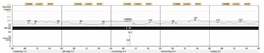 . CARELINK RAPPORTER SENSOR- OCH MÄTARÖVERSIKT ( AV ) Den här rapporten sammanfattar blodsocker, sensorglukos, kolhydrater, och insulininformation.