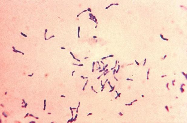 Behandling av kutan leishmaniasis Beror på subtyp (PCR-svar) Behandla eller inte behandla?