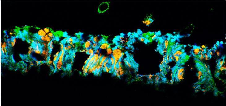 Nitrifikation För nitrifikation brukar man använda sig av biofilmreaktorer AOB och NOB fäster bra på de flesta material, bildar en relativt fast film som klarar skjuvkrafter väl och gör att de klarar