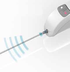 NeoNavia kommer med en handfull unika funktioner som gör systemet redo att ersätta dagens föråldrade metoder: Mikropulsteknik Precisionsplacering av nål, millimeter för millimeter, för optimal