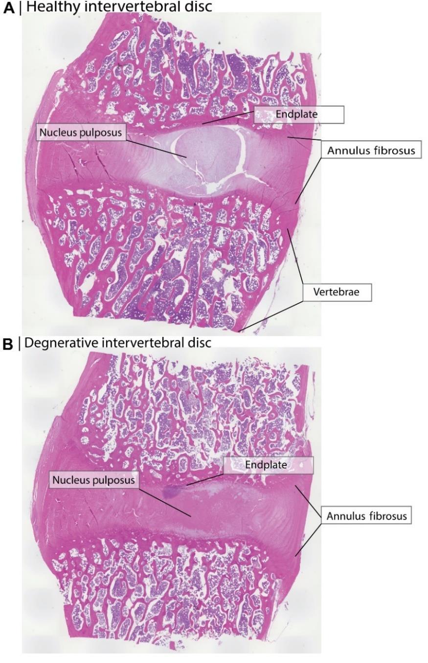 Figur 2. (A) Visar ett sagittalt snitt (H&E) av en frisk intervertebral disk från en hund. Nucleus pulposus (NP) med gelatinös struktur.