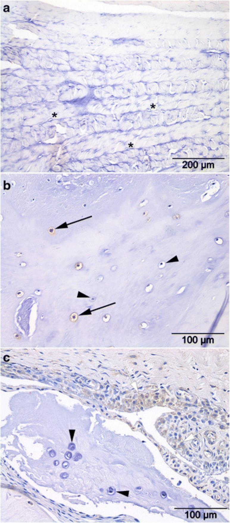 Figur 3. Histologiskt snitt av dorsala annulus fibrosus (AF) från en hund. (a) AF med välorganiserade kollagenlameller med fibroblaster (asterisk).