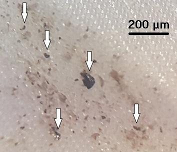 4.4.3 Mikroskopering Rissne BP 2 Från Rissne BP 2 togs vattenprover ifrån samtliga sex lysimetrar som är nedgrävda där. Det kom dock endast relevanta vattenmängder ifrån två av dem.