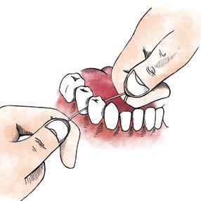 Skölj munnen upp till tre gånger om dagen eller enligt tandläkarens instruktioner.