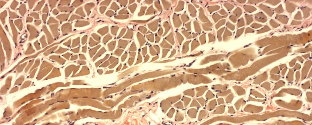 (duodenum) Preparat 42: Gommens slemhinna hos foster Preparat 49: Tjocktarm Preparat 44: Matstrupen Preparat: 50: Blindtarmsbihang Litteraturhänvisningar: RP6u = Ross & Pawlina: Histology.