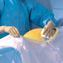 Obstetrik och gynekologi Obstetriska ingrepp såsom kejsarsnitt är på flera sätt en utmaning för operationsdraperingsmaterial.