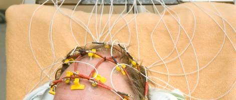 2012:47 EEG vid psykos K an EEG bidra till korrekt diagnostik av psykotisk sjukdom, eller till uteslutande av annan cerebral sjukdom, hos patienter med förstagångsinsjuknande i psykotiska symtom, i