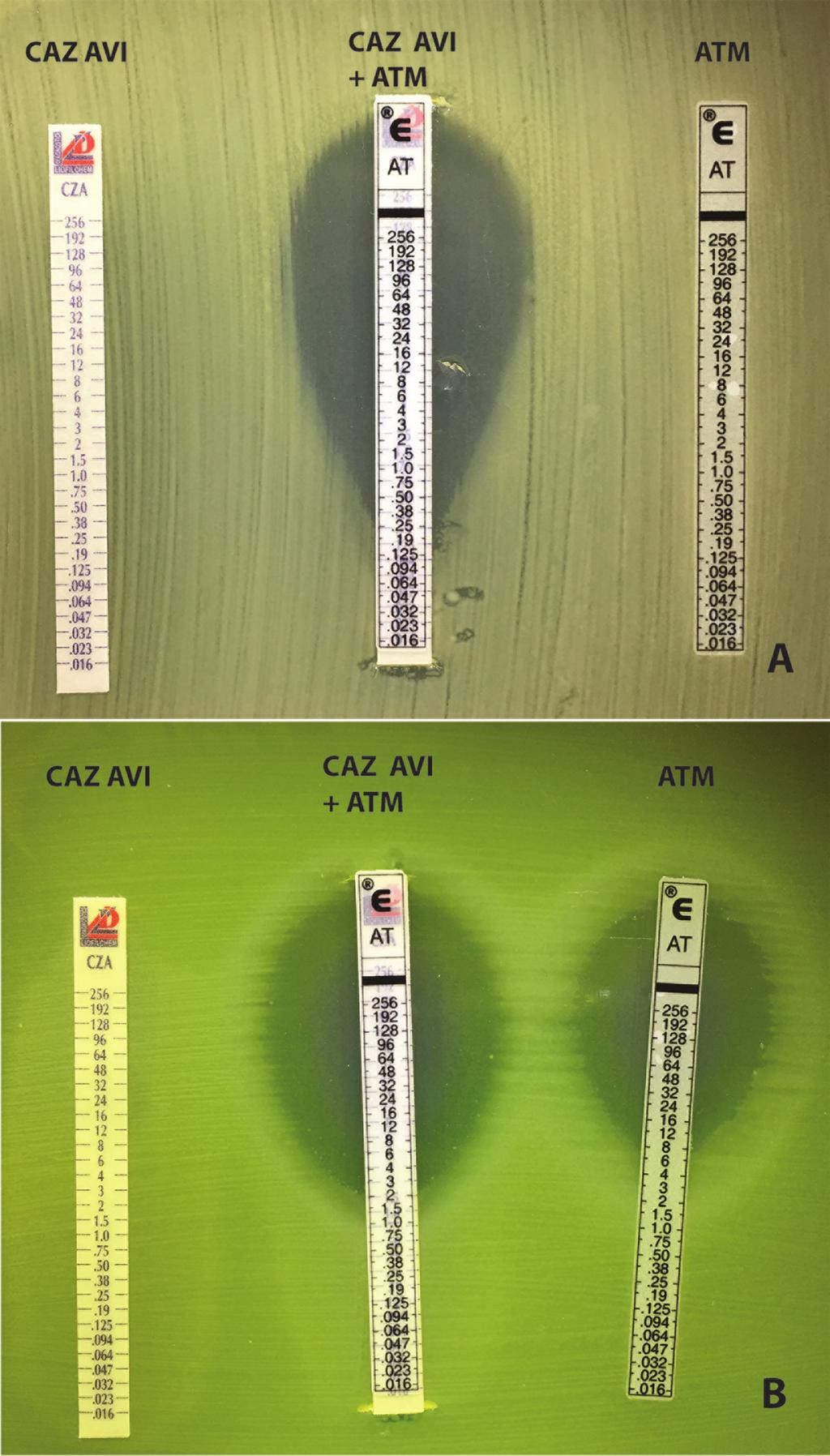 Ceftazidim/avibactam + aztreonam?