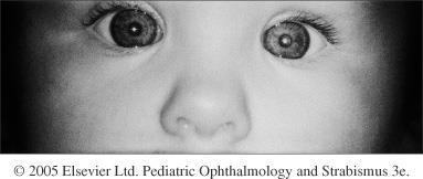 Differentialdiagnos