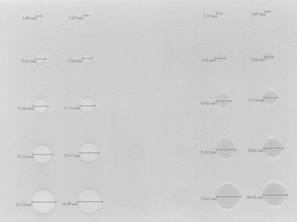 Sammandrag från publikationer Mätnogrannhet A phantom study of nodule size evaluation Johnsson et al.