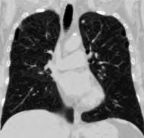 Kostnader Investering CXR CXR+20% CT Undersökning 3-5min CXR+2min