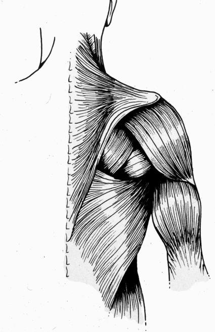 Latissimus Dorsi viktig skuldersänkare