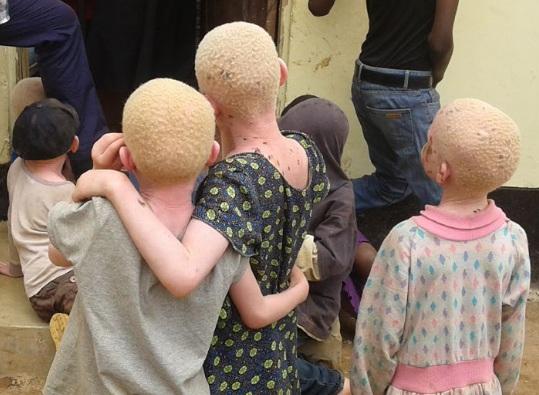 Från förföljelse till trygghet Finska Missionssällskapets fasteinsam ling stöder den lutherska kyrkans kamp för att rädda barn m ed albinism i Tanzania, som enligt FN är världens farligaste land för