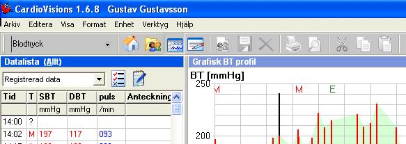 verktygsfältet. Om du klickar på en enskild registrering i tabellen så markeras denna registrering med automatik i fönstret för den grafiska presentationen.