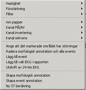 släpper musknappen. Området är nu markerat med röda linjer. Klicka därefter på ikonen Lägg till event (ikonen med den gröna pilen i EKG översiktens nedre del), varvid fönstret Lägg till event öppnas.