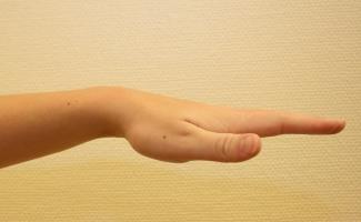 Grupp 1 Kan aktivt sträcka fingrarna fullt med bättre handledssträckning än 20º