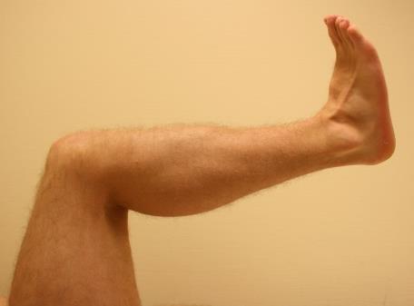 Fot Dorsalflexion med flekterat knä Utgångsställning: Ryggliggande, 90 flexion i höft och knä. Stabilisera den subtalara leden genom att fixera calcaneus.