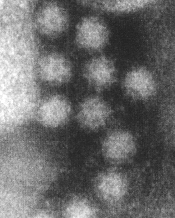 Norwalk-liknande virus Norovirus