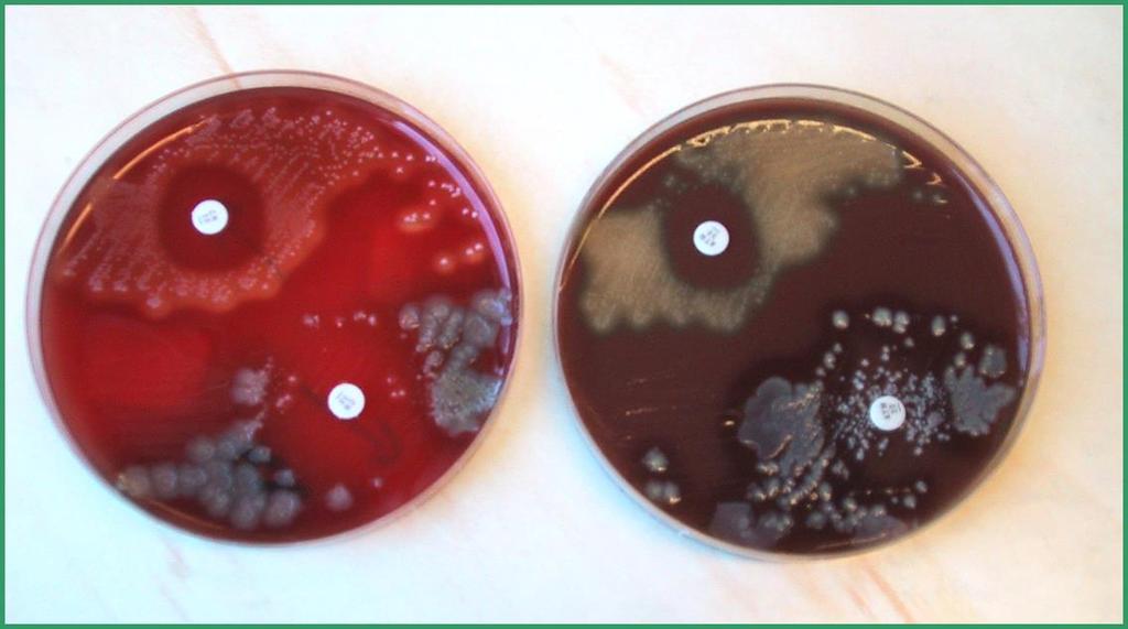 Huvudpatogener Streptococcus pneumoniae Haemophilus influenzae