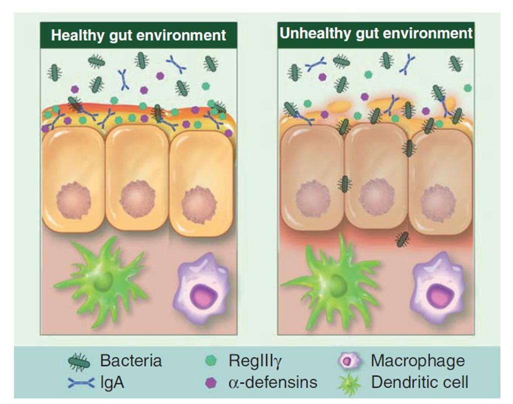 Mikrobiell dysbios artrikedom minskar sammansättning av arter förändras Bacteriodetes Firmicutis C. T.