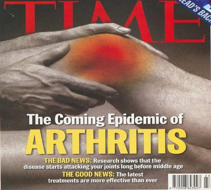 Time, 2003 Vanligaste ledsjukdomen Artros Större delen av befolkningen >50 år är drabbad av röntgenologisk artros Överrisk för yngre