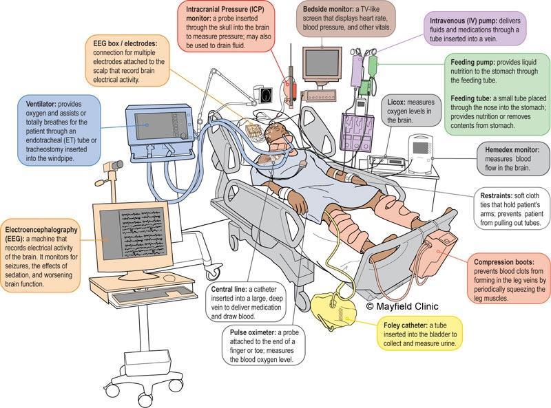 diagnostisera status epilepticus och följa behandling; Blivit nästan rutin hos