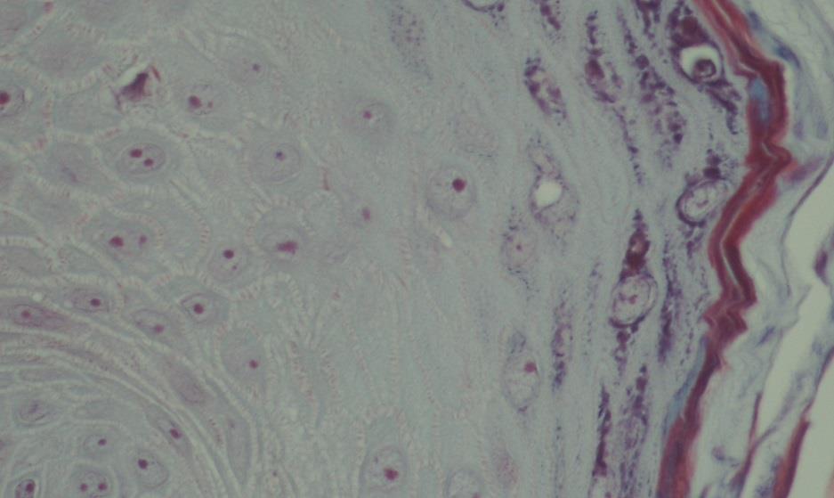 Desmosomer kan ses mellan epitelcellerna. Figur 9.