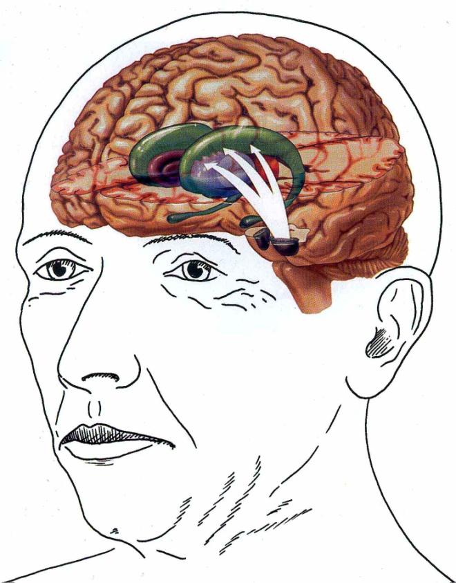 Vilka symtom hos vilken patient? Alla drabbas inte av alla dessa symtom. Parkinsons sjukdom kan se väldigt olika ut hos olika personer. Symtomen varierar också under sjukdomens olika faser.