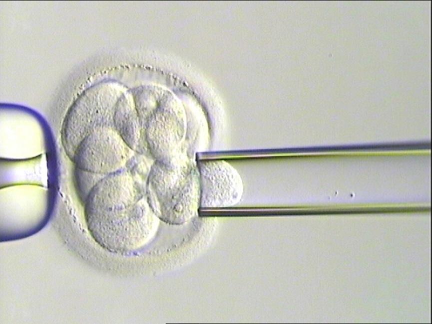 PGD indikationer Strukturella kromosomavvikelser ex. translokationer (reciproka el.